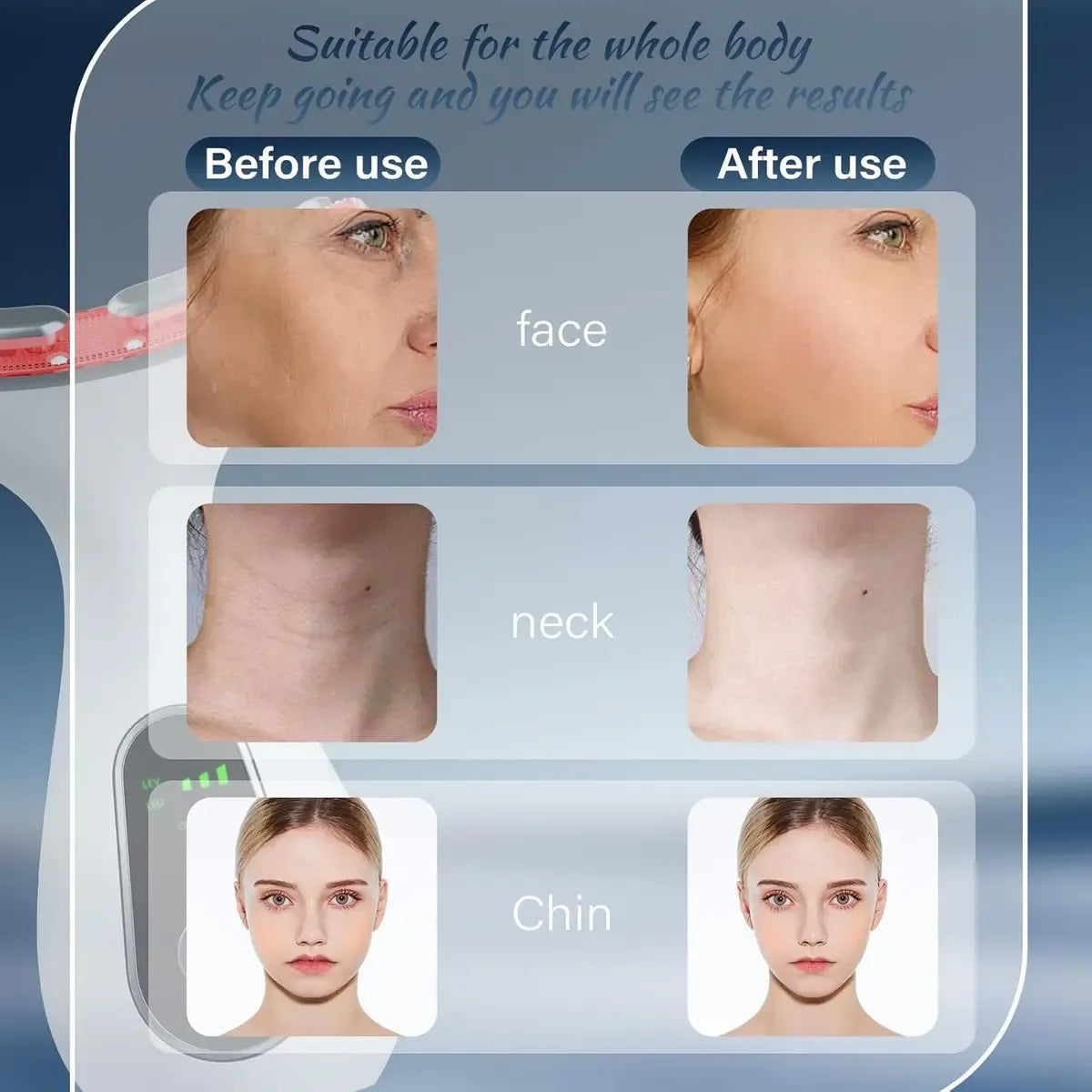Masajeador Facial Led Antiarrugas